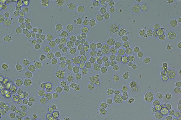 K562 cells