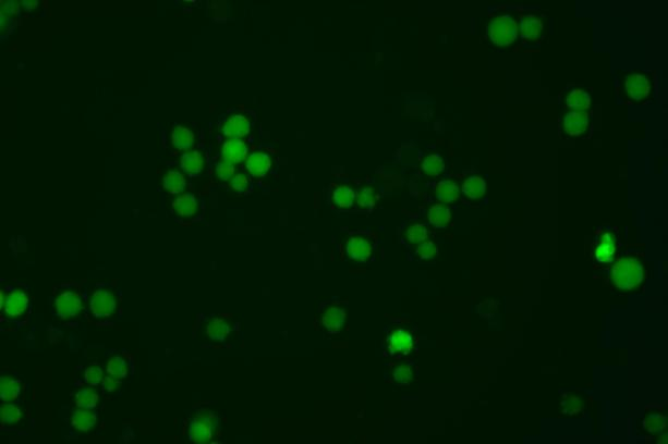 EGFP knock-in in K562 cells.