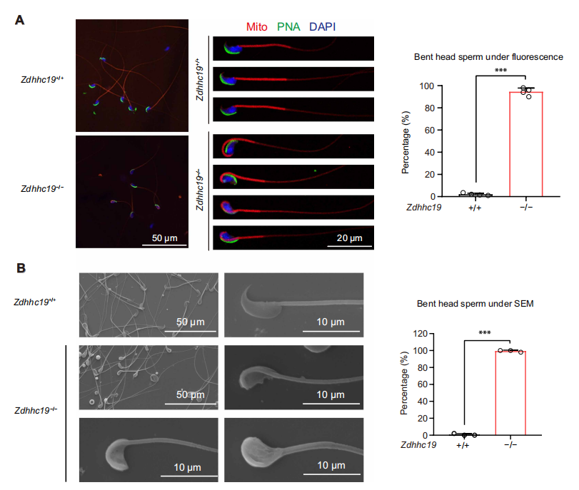 Zdhhc19 deletion impairs spermatogenesis by disrupting chromatin condensation