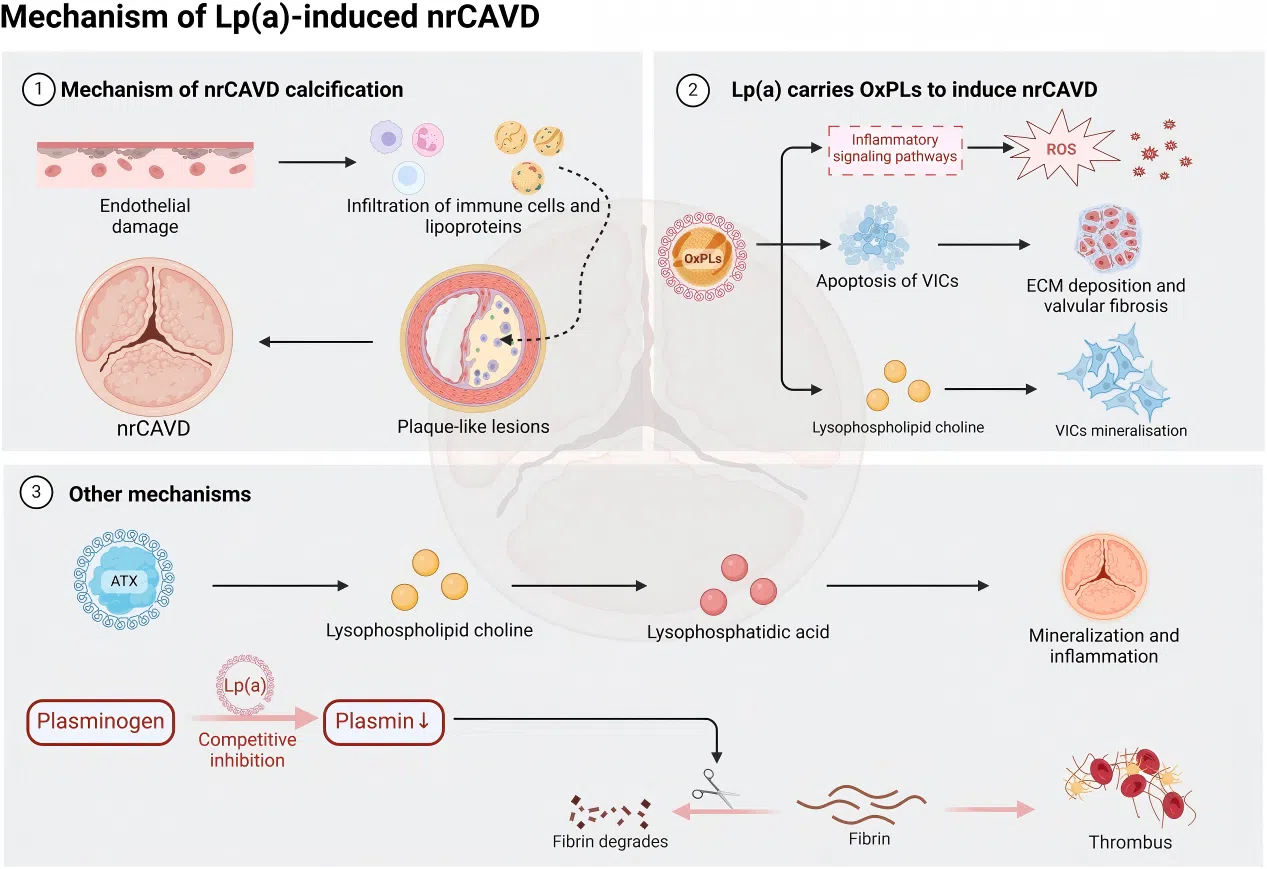 Figure 3. The impact of Lp(a) on nrCAVD pathogenesis